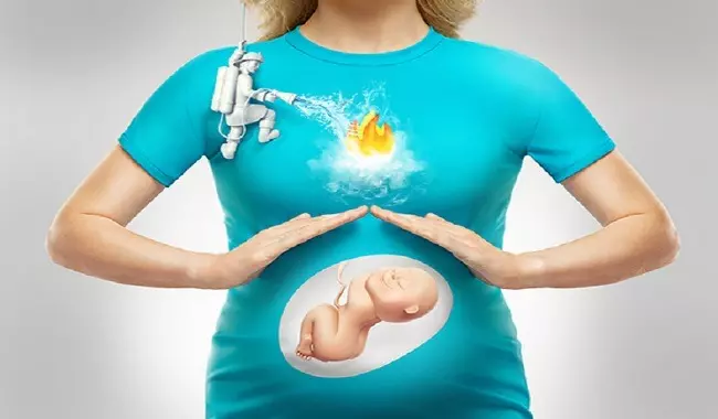 سوزش معده در بارداری