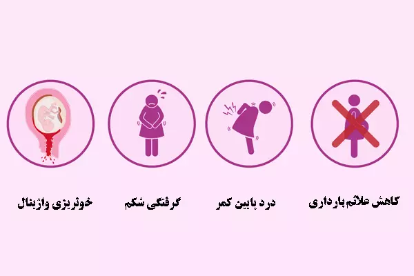 سقط جنین